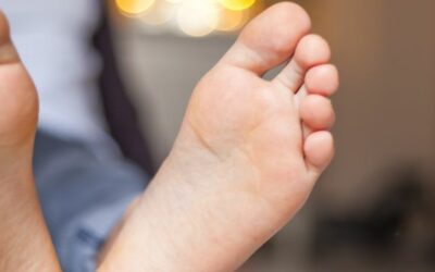 Piede piatto nel bambino: cosa fare?
